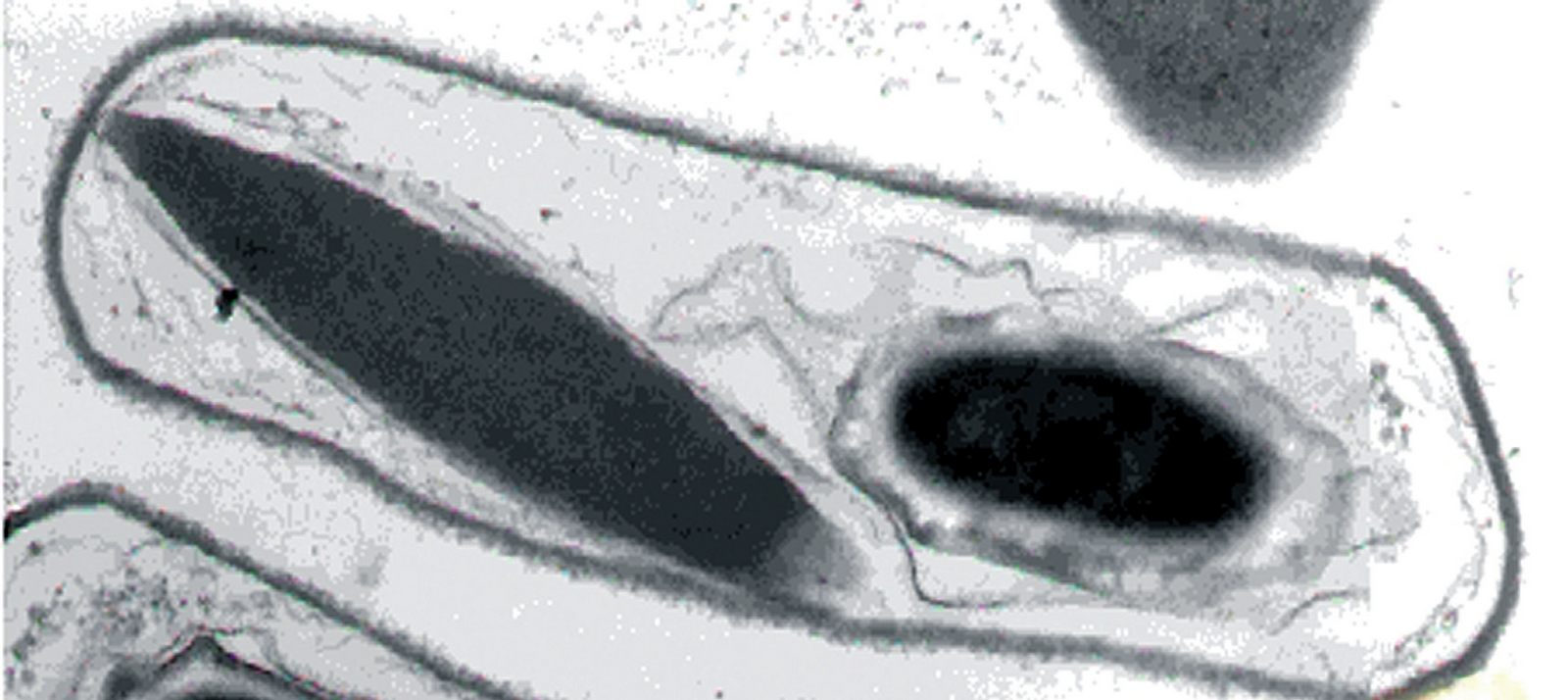 Microfotografía de Bacillus thuringiensis en microscopio electrónico de transmisión